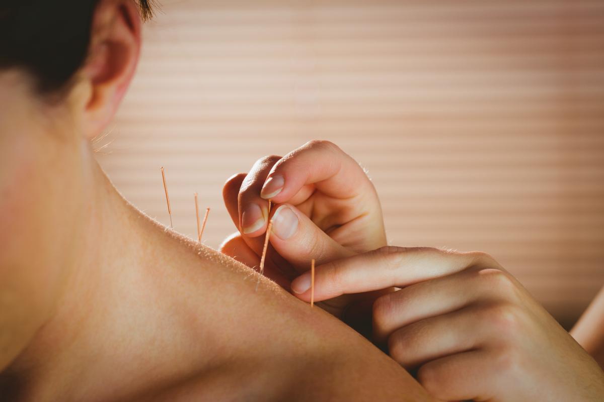 Reasons to Try Acupuncture for Depression and Anxiety